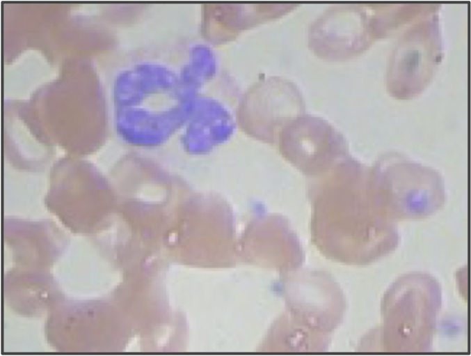 Neutrophil